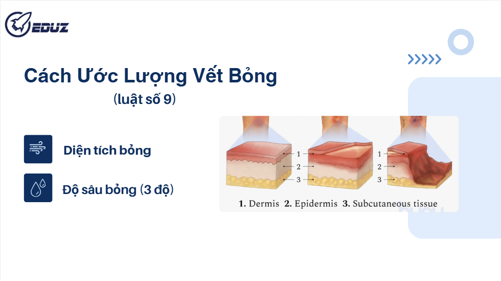 2. Cách ước lượng vết bỏng